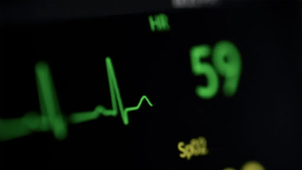 Digital display of a heart rate monitor showing cardiac data and waveforms